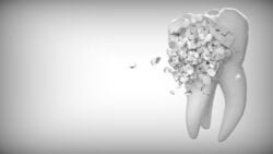 side effect animation of dental implants