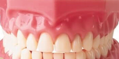 Prosthetic Teeth