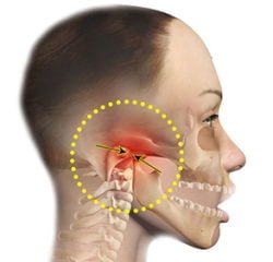 TM dental problem