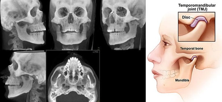 TM dental problem